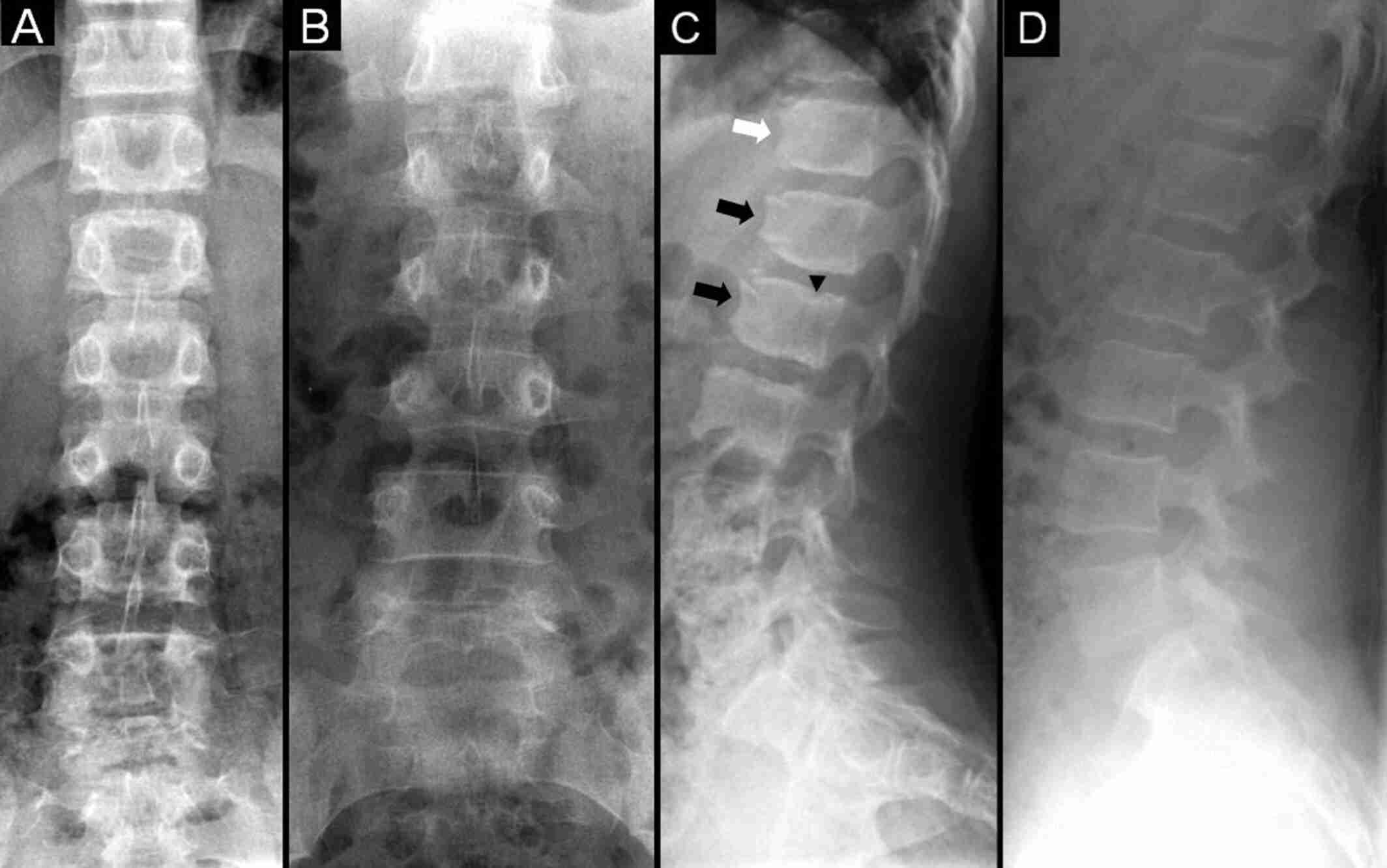 jbmr4827-fig-0001-m.jpg