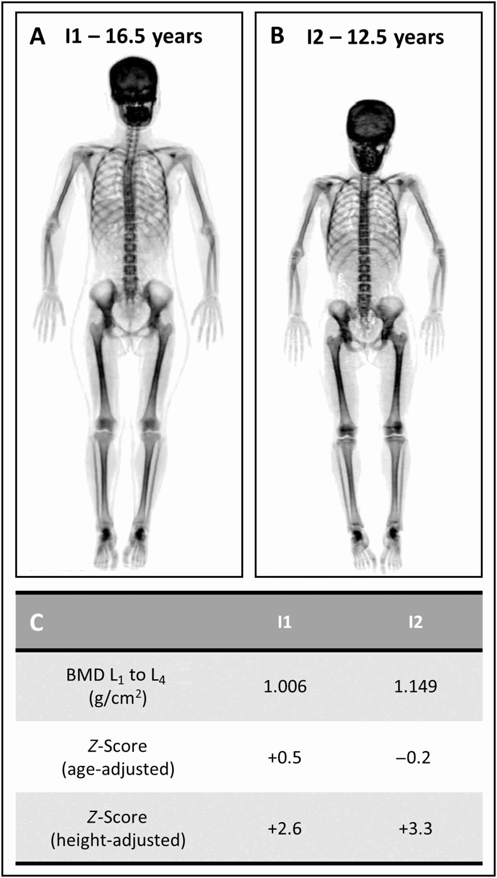 jbmr4827-fig-0002-m.jpg